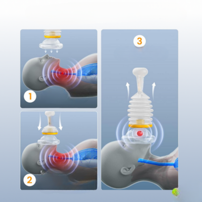 מכשיר חירום לשאיבת חנק - safy™